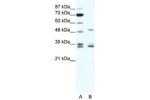 Western Blot showing ZNF488 antibody used at a concentration of 1-2 ug/ml to detect its target protein. (ZNF488 抗体  (C-Term))