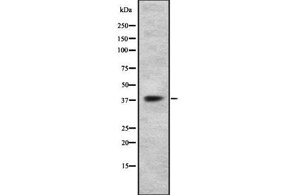 P2RY14 抗体  (Internal Region)