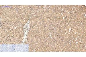 Immunohistochemistry of paraffin-embedded Human liver tissue using Transferrin Monoclonal Antibody at dilution of 1:200. (Transferrin 抗体)