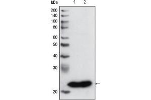 Western Blot showing using GSTP1 antibody used against PC3 cell lysate (1) and human cerebellum tissue lysate (2). (GSTP1 抗体)
