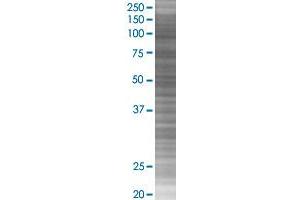 GMPS transfected lysate. (GMPS 293T Cell Transient Overexpression Lysate(Denatured))