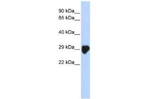 Carbonic Anhydrase I antibody used at 1 ug/ml to detect target protein. (CA1 抗体  (N-Term))