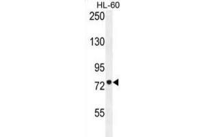 Western Blotting (WB) image for anti-Carnitine Palmitoyltransferase 1C (CPT1C) antibody (ABIN2996207) (CPT1C 抗体)