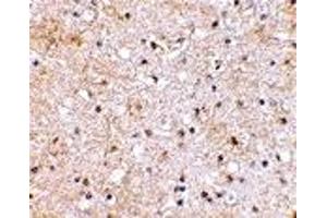 Immunohistochemistry (IHC) image for anti-Glutamate Receptor, Ionotropic, Kainate 1 (GRIK1) (C-Term) antibody (ABIN1030421) (GRIK1 抗体  (C-Term))