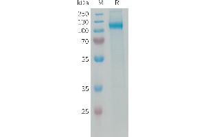 AOC3 Protein (AA 28-763) (His tag)