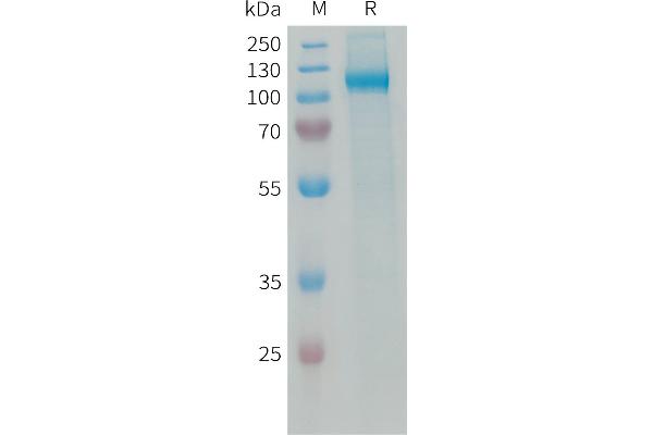 AOC3 Protein (AA 28-763) (His tag)