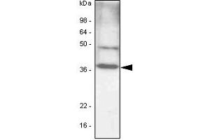The cell lysates (40ug) were resolved by SDS-PAGE, transferred to PVDF membrane and probed with anti-human C/EBP-beta antibody (1:1000). (CEBPB 抗体)