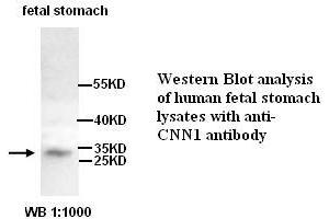 Image no. 1 for anti-Calponin antibody (ABIN790877) (Calponin 抗体)