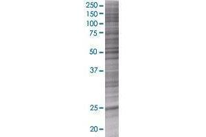 SFRS12IP1 transfected lysate. (P18SRP 293T Cell Transient Overexpression Lysate(Denatured))