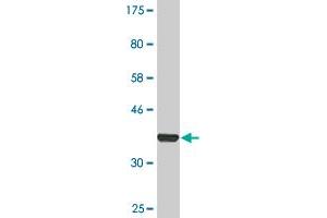 Western Blot detection against Immunogen (36. (Transferrin Receptor 抗体  (AA 68-168))