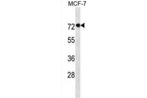 AGAP11 抗体  (N-Term)