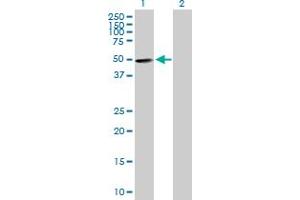 Western Blot analysis of ZNF383 expression in transfected 293T cell line by ZNF383 MaxPab polyclonal antibody. (ZNF383 抗体  (AA 1-475))