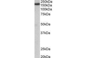 Western Blotting (WB) image for anti-Zinc Finger, CCHC Domain Containing 11 (ZCCHC11) (Internal Region) antibody (ABIN2464955) (ZCCHC11 抗体  (Internal Region))