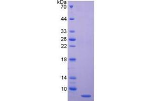 SDS-PAGE analysis of Human C4BPa Protein. (C4BPA 蛋白)