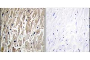 Immunohistochemistry (Paraffin-embedded Sections) (IHC (p)) image for anti-Cytochrome P450, Family 2, Subfamily J, Polypeptide 2 (CYP2J2) (AA 231-280) antibody (ABIN2889947) (CYP2J2 抗体  (AA 231-280))