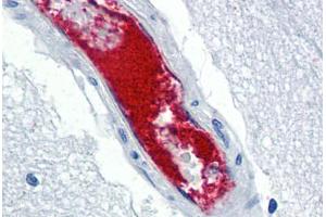 Human Brain, Cortex, Vessel (formalin-fixed, paraffin-embedded) stained with VWF antibody ABIN337312 at 5 ug/ml followed by biotinylated anti-goat IgG secondary antibody ABIN481715, alkaline phosphatase-streptavidin and chromogen. (VWF 抗体)