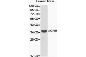 Western Blotting (WB) image for anti-Corticotropin Releasing Hormone (CRH) antibody (ABIN1872000) (CRH 抗体)
