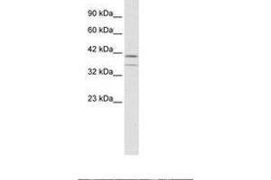 Image no. 1 for anti-CCAAT/enhancer Binding Protein (C/EBP), beta (CEBPB) (AA 239-288) antibody (ABIN6735936) (CEBPB 抗体  (AA 239-288))