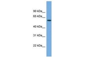 Image no. 1 for anti-Adenylate Kinase 5 (AK5) (AA 107-156) antibody (ABIN6743261) (Adenylate Kinase 5 抗体  (AA 107-156))