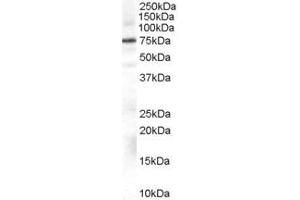 Western Blotting (WB) image for anti-Adrenergic, Beta, Receptor Kinase 1 (ADRBK1) (AA 319-331) antibody (ABIN296681) (GRK2 抗体  (AA 319-331))