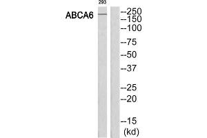 Western Blotting (WB) image for anti-ATP-Binding Cassette, Sub-Family A (ABC1), Member 6 (ABCA6) (C-Term) antibody (ABIN1850838) (ABCA6 抗体  (C-Term))