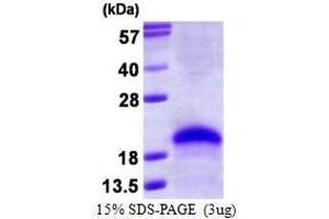 Figure annotation denotes ug of protein loaded and % gel used. (VEGF 165 蛋白)