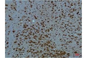 Immunohistochemical analysis of paraffin-embedded Mouse BrainTissue using PI3 Kinase P85 α Mouse mAb diluted at 1:200. (PIK3R1 抗体)