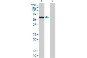 Western Blotting (WB) image for anti-Glucosidase, Beta, Acid (GBA) (AA 146-235) antibody (ABIN561009)