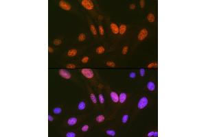 Immunofluorescence analysis of U-2 OS cells using HIPK2 Rabbit mAb (ABIN7267779) at dilution of 1:100 (40x lens). (HIPK2 抗体)