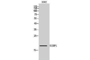 Western Blotting (WB) image for anti-Glucuronidase, beta Pseudogene 1 (GUSBP1) (Internal Region) antibody (ABIN3184964) (GUSBP1 抗体  (Internal Region))