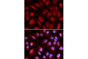 Immunofluorescence analysis of U2OS cells using MCM5 antibody. (MCM5 抗体)