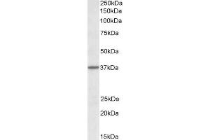 ABIN571219 (1µg/ml) staining of Mouse Brain lysate (35µg protein in RIPA buffer). (CADM1 抗体  (Internal Region))