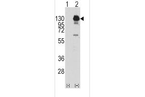 Western blot analysis of PDGFRA using rabbit polyclonal PDGFRA Antibody (Y762) using 293 cell lysates (2 ug/lane) either nontransfected (Lane 1) or transiently transfected with the PDGFRA gene (Lane 2). (PDGFRA 抗体  (AA 740-769))