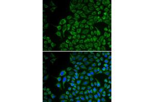 Immunofluorescence analysis of U2OS cells using TYR antibody (ABIN5970593). (TYR 抗体)