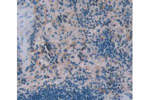 Used in DAB staining on fromalin fixed paraffin- embedded Kidney tissue (WASP 抗体  (AA 1-298))