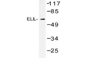 Western blot (WB) analysis of ELL antibody in extracts from Jurkat cells. (ELL 抗体)