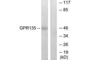 Western blot analysis of extracts from NIH-3T3 cells, using GPR135 antibody. (GPR135 抗体  (C-Term))