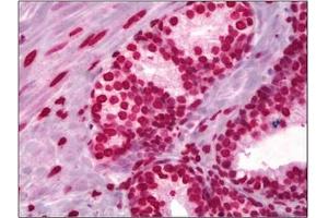 Immunohistochemical analysis using Histone H3 antibody at 5 µg/ml on Human Prostate tissue (Formalin-fixed, Paraffin-embedded). (Histone 3 抗体)