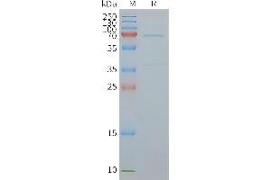 Human EN-Nanodisc, Flag Tag on SDS-PAGE (ENTPD2 蛋白)