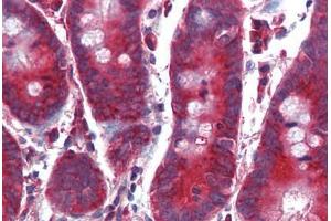 Human Small Intestine (formalin-fixed, paraffin-embedded) stained with TFRC antibody ABIN305731 at 5 ug/ml followed by biotinylated anti-mouse IgG secondary antibody ABIN481714, alkaline phosphatase-streptavidin and chromogen. (Transferrin Receptor 抗体  (AA 3-28))