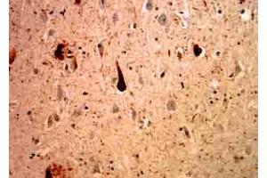 MCA-Ubi-1 staining of cerebral cortex of an Alzheimer patient. (Ubiquitin 抗体)