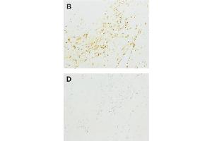 Immunohistochemistry image of acrolein adduct staining in paraffn sections of human atherosclerotic tissue. (ACR-Modified KL 抗体)