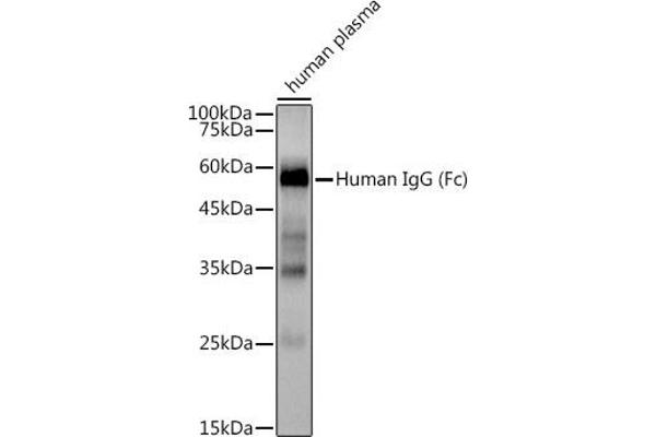 IGHG1 抗体
