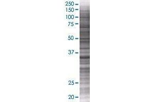 ZNF524 transfected lysate. (ZNF524 293T Cell Transient Overexpression Lysate(Denatured))