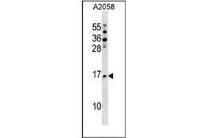 Western blot analysis of NAT5 Antibody (C-term) in A2058 cell line lysates (35ug/lane). (NAT5 抗体  (C-Term))