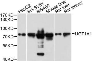 Western blot analysis of extracts of various cell lines, using UGT1A1 antibody (ABIN1875274) at 1:1000 dilution. (UGT1A1 抗体)