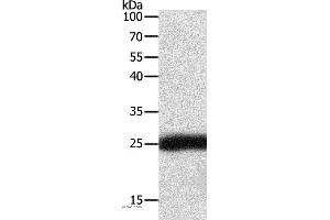 Western blot analysis of Hela cell, using SNAP25 Polyclonal Antibody at dilution of 1:400 (SNAP25 抗体)