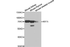 Western blot analysis of extracts of various cell lines, using KRT5 antibody (ABIN5971441) at 1/500 dilution. (Cytokeratin 5 抗体)