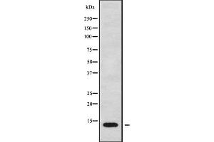 Western blot analysis MT-ND4L using MCF7 whole cell lysates. (MT-ND4L 抗体)