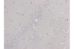 Immunohistochemistry (IHC) image for anti-Tubulin, beta 3 (TUBB3) (N-Term) antibody (ABIN1854950) (TUBB3 抗体  (N-Term))